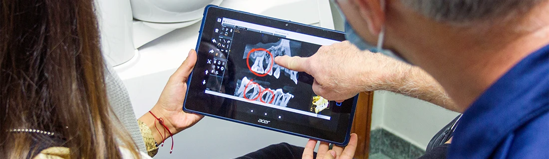 FC – Dental Implants in Tacoma WA: Hansen Dentistry